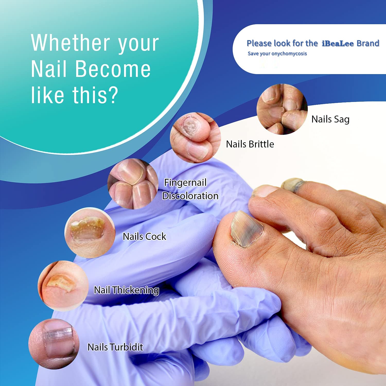 Toenail Fungus Treatment: Pros and Cons of Popular Options and Why Finding  the Best One is Crucial | Free Assessment Available