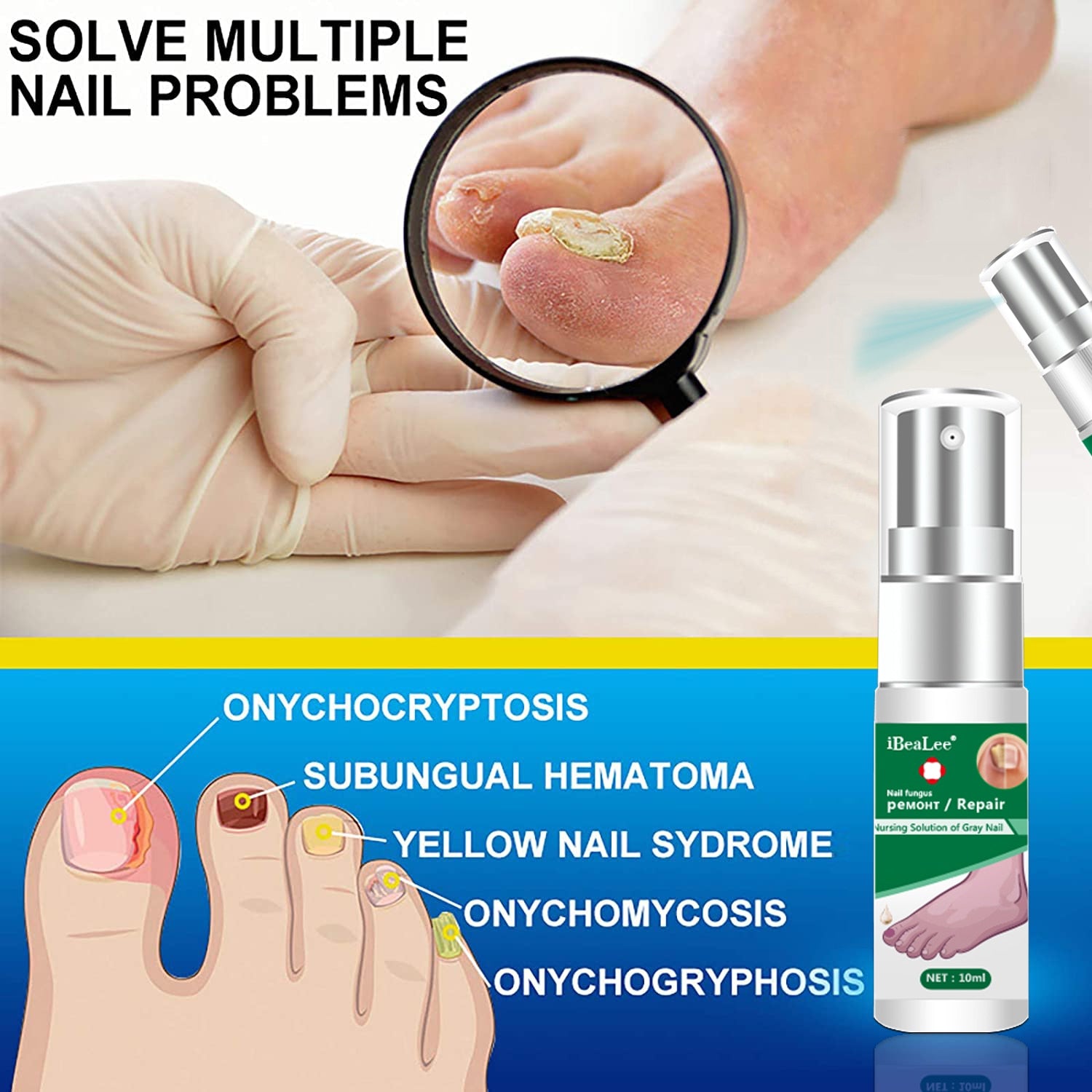 THERA HEALTHCARE Anti Fungal Nail Treatment for Toenails Extra Strong India  | Ubuy