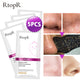 5pcs Powerful Pore Strips + Skin Soother - Removes Deep Rooted White Heads + Blackheads