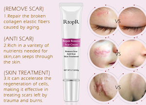 Intense Scar Removal Treatment (Works on Acne Scars Too)